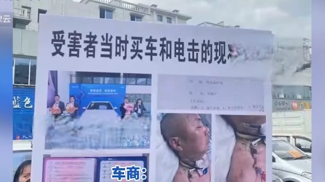 比亚迪漏电车主疑脑溢血，女儿：没有诋毁，医生诊断电击伤